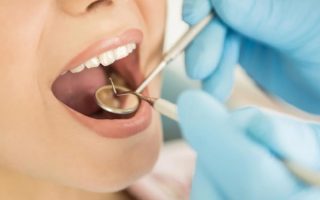 tooth extractions in Miami