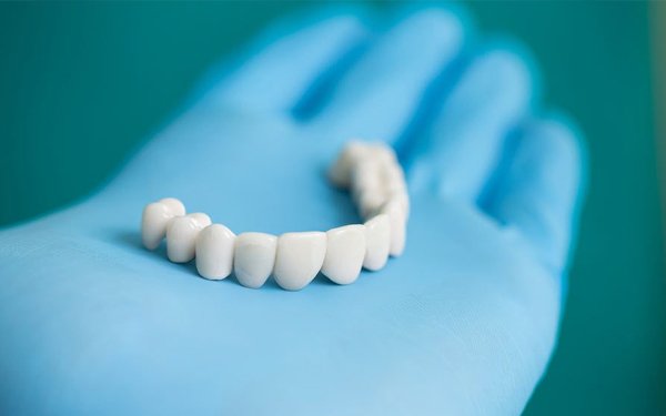 dental implants Miami