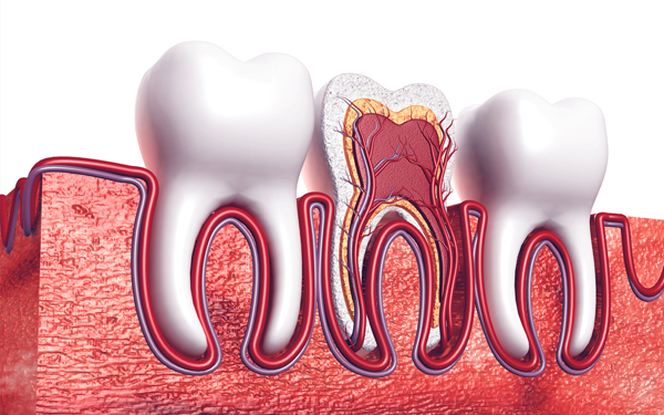 root canal treatment in Miami